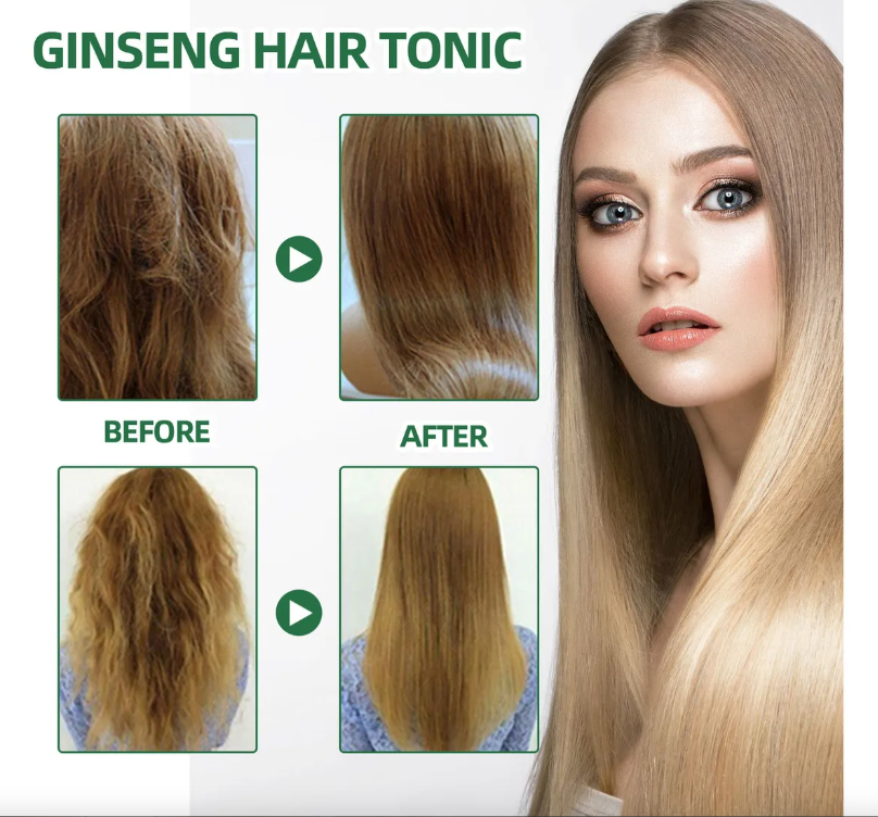 Tónico para el crecimiento del cabello, líquido para evitar la caída del cabello, reparación de Alopecia, crecimiento más rápido