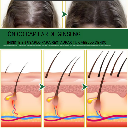 Tónico para el crecimiento del cabello, líquido para evitar la caída del cabello, reparación de Alopecia, crecimiento más rápido